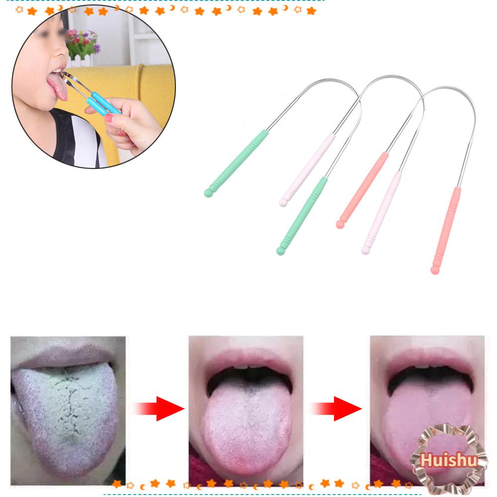 Dụng Cụ Nạo Vệ Sinh Răng Miệng Bằng Thép Không Gỉ Chất Lượng Cao