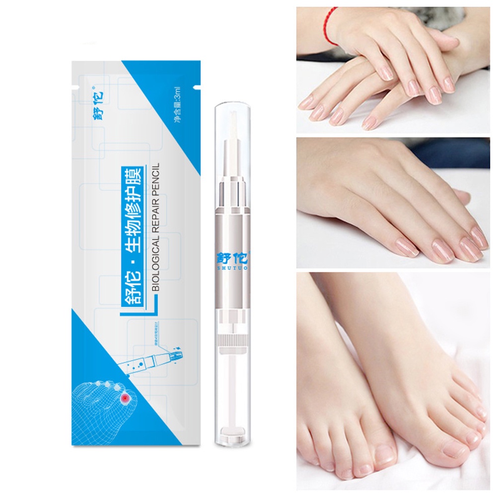 Dung Dịch Hỗ trợ giảm nấm Móng Tay 3ml Chất Lượng Cao
