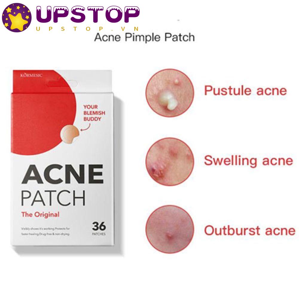 Miếng Dán Hỗ trợ giảm mụn Giúp Hấp Thụ Thạch Cao Hiệu Quả