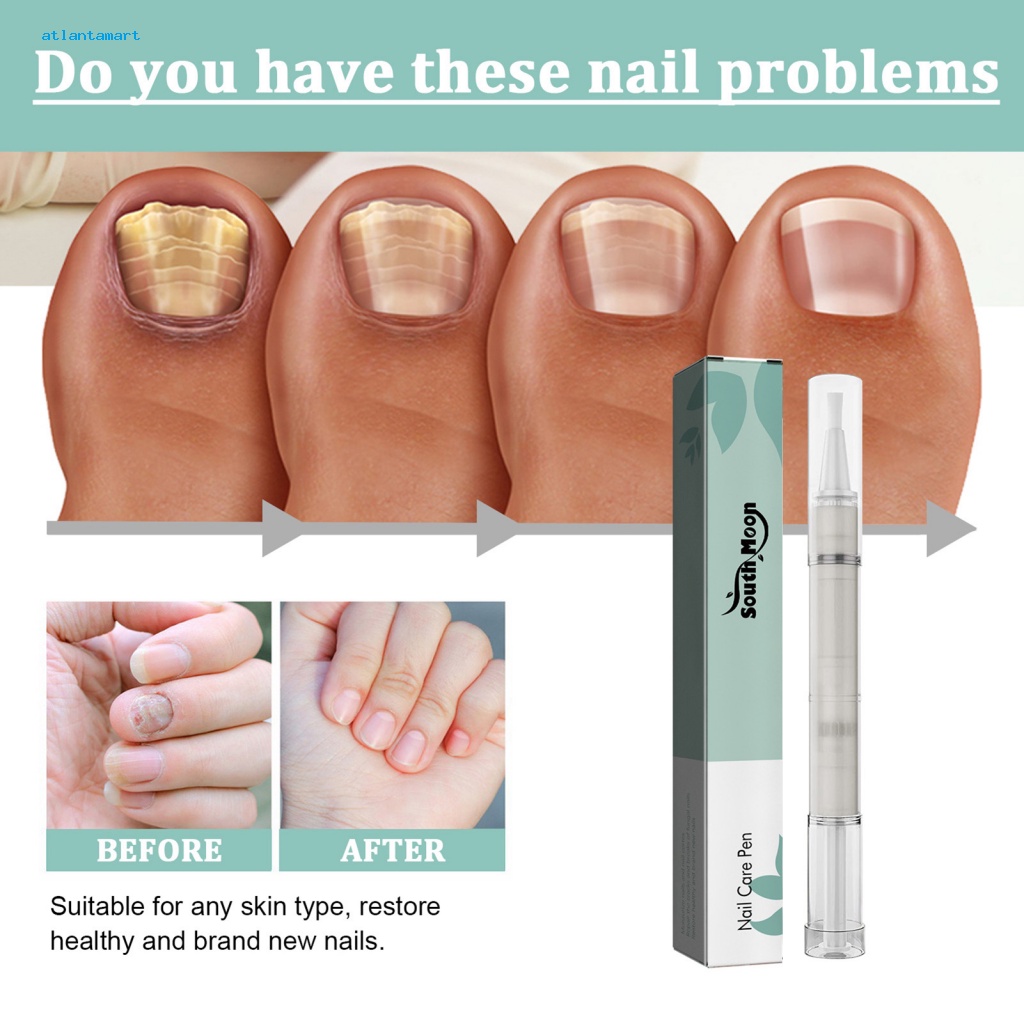 Túi Đựng Đồ Dùng Cao Cấp Tiện Dụng| Bút Dầu Tràm Trà Tự Nhiên 4ML Nuôi Dưỡng Móng Tay / Móng Chân Tẩy Tế Bào Chết Lâu Trôi