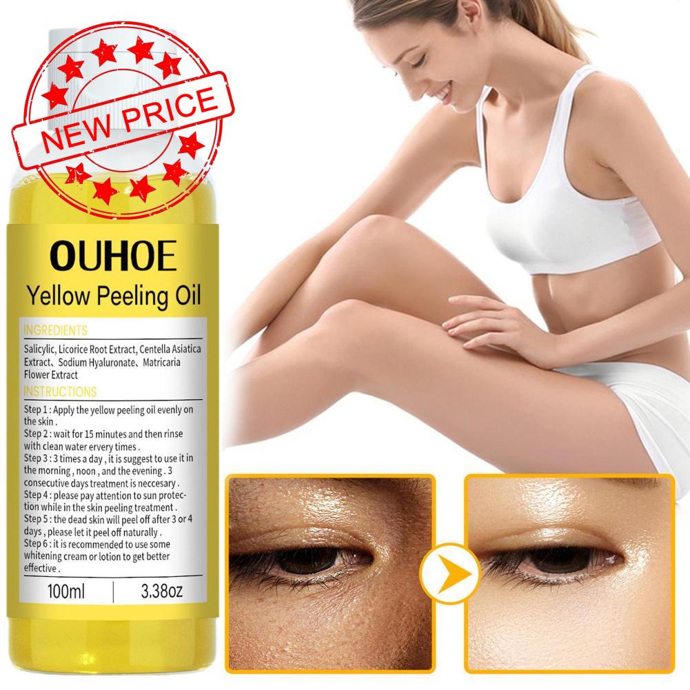 Tinh Dầu Tẩy Tế Bào Chết Màu Vàng Làm Trắng Sáng Da F5P0