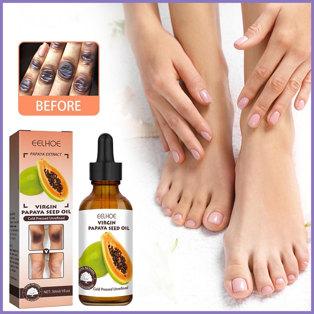 Hạt Đu Đủ Loại Bỏ Đốm Đen 1fl oz Làm Sáng Khớp Nối Cho Khuỷu Tay Đầu Gối Và Khớp Làm Sáng nota2vn