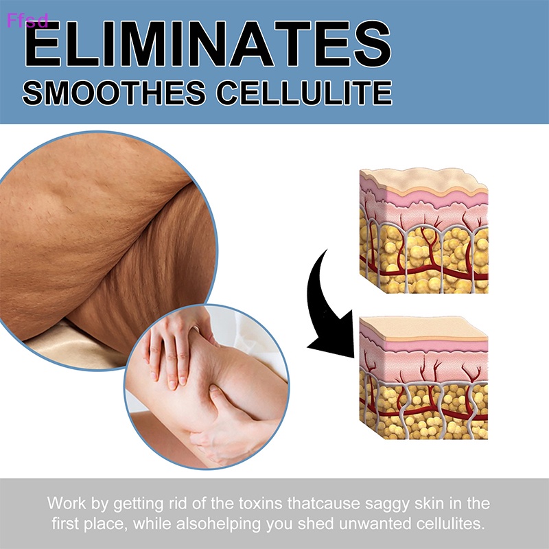 Set 10 Miếng Dán Nâng Đùi Chống Cellulite &amp; Chảy Xệ