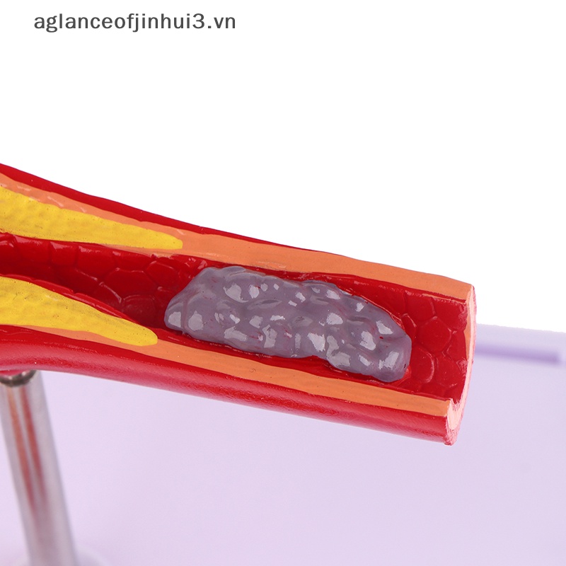 Mô Hình Tượng Người Vessel 50 Lần Trang Trí Phòng Thí Nghiệm