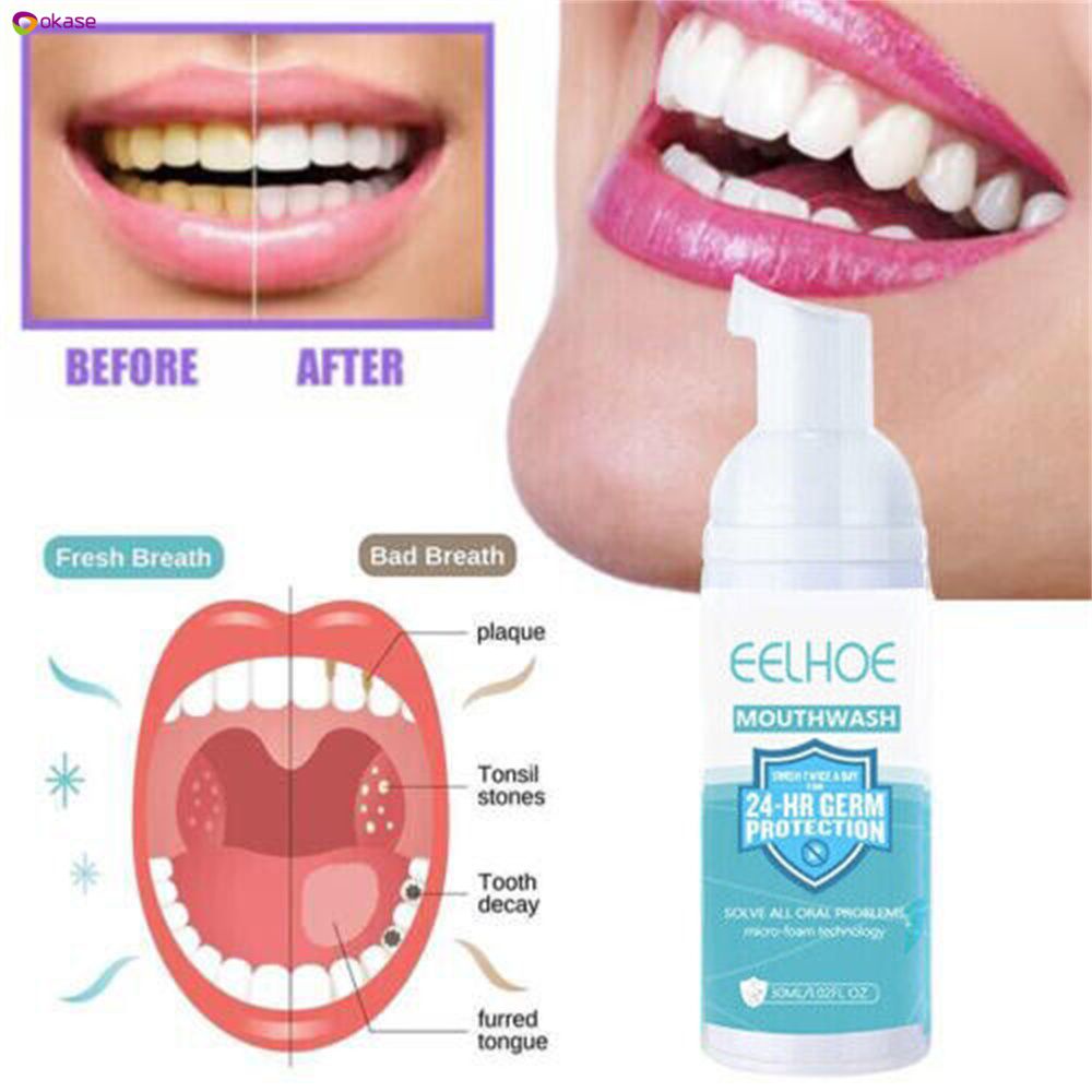 Nước súc miệng Eelhoe Teethaid, Bọt làm trắng răng bạc hà Mousse Stain Remove Uk okase