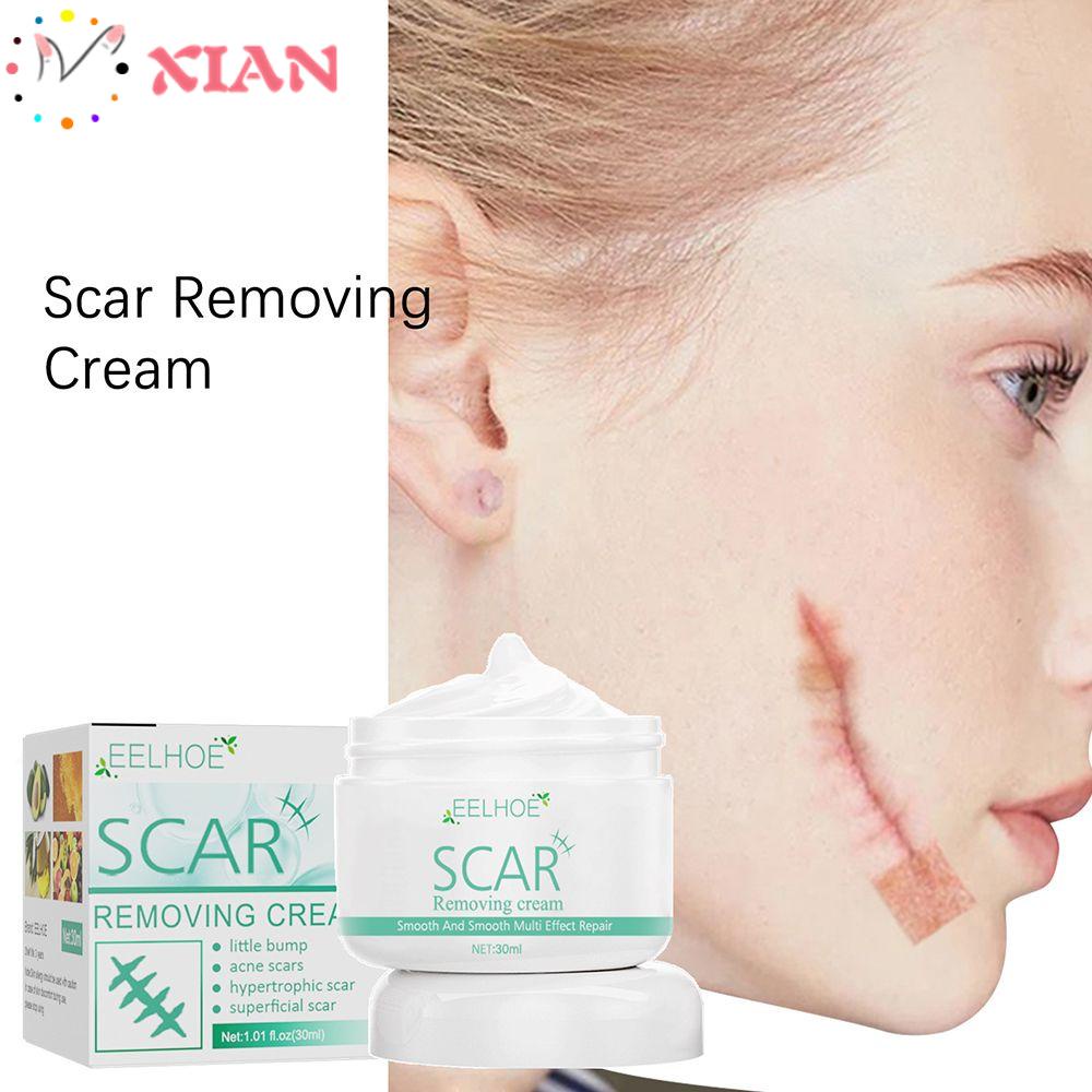 Kem Hỗ trợ giảm sẹo XIANTIN Chất Lượng Cao Tiện Dụng