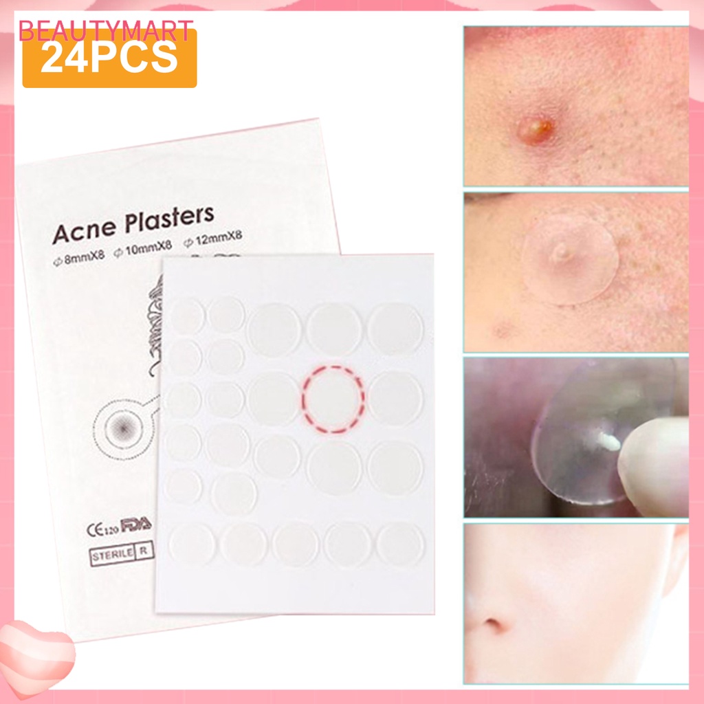 Set 24 Miếng Dán Hỗ trợ giảm mụn Chống Thấm Nước Thông Dụng