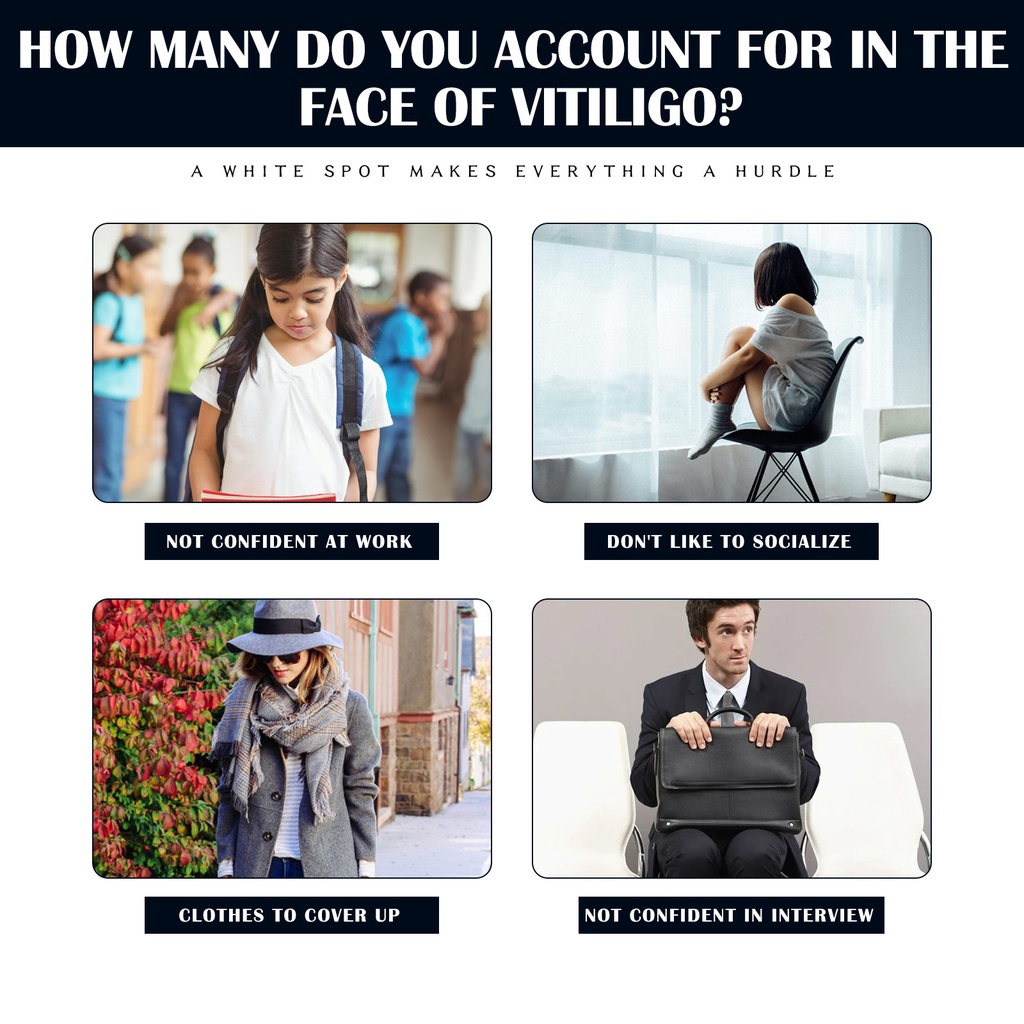 Tik Tok Bán Chạy#South Chai Xịt Tẩy Trang Làm Sạch Xương Đốm Trắng Da Ngoài Trời 6.30 cjL