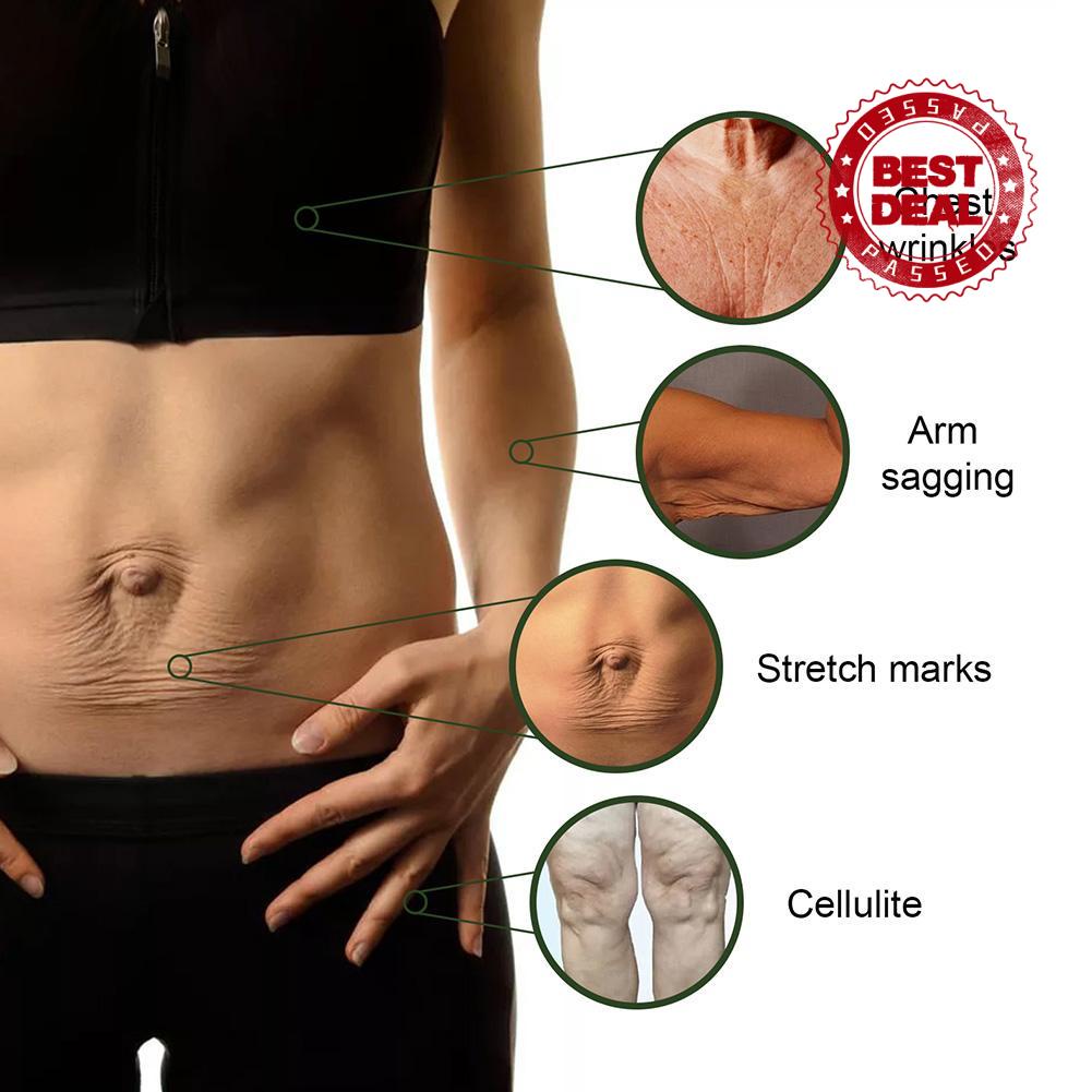 Kem tẩy tế bào chết trắng da Chiết Xuất Bơ Làm Sáng Da Chống Nếp Nhăn V8M3