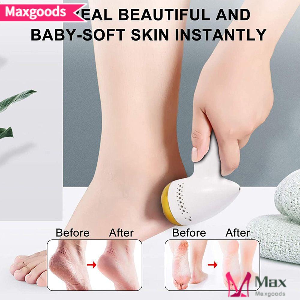 MAXG Dụng Cụ Dũa Đánh Bóng Móng Chân Di Động Tiện Dụng