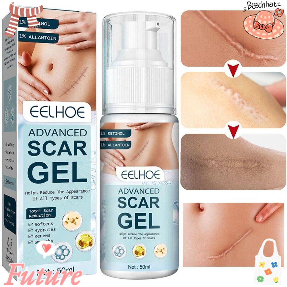 FUTURE Kem Hỗ trợ giảm sẹo Phẫu Thuật Hiệu Quả Cho Nam Nữ