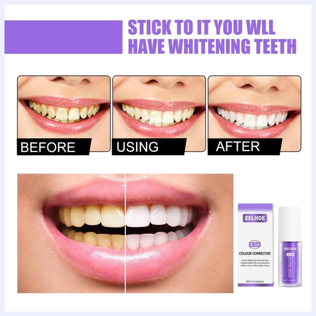 Kem Đánh Răng SMILEKIT / ALIVER / Eelhoe / Hismile Làm Trắng Răng V34 Chống Nhạy Cảm