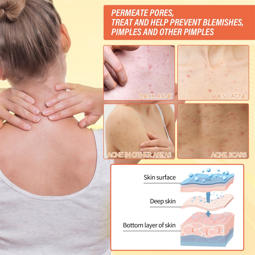 Xà Phòng Axit Kojic Làm Sáng Da Tay Làm Sạch Sâu