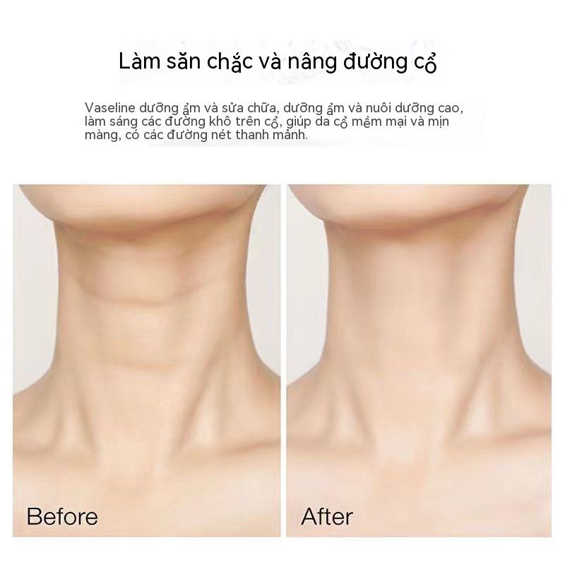 Kem Massage Cổ Vaseline Giúp Làm Trắng Xóa Nếp Nhăn Làm Săn Chắc Da