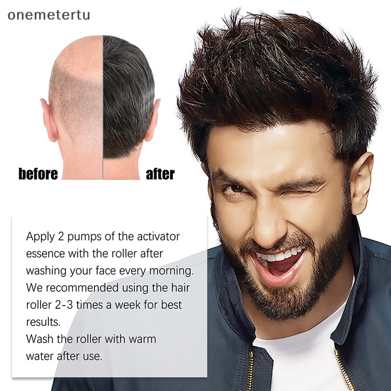 Con Lăn Massage Kích Thích Mọc Tóc Và Râu Chống Rụng Tóc Hiệu Quả