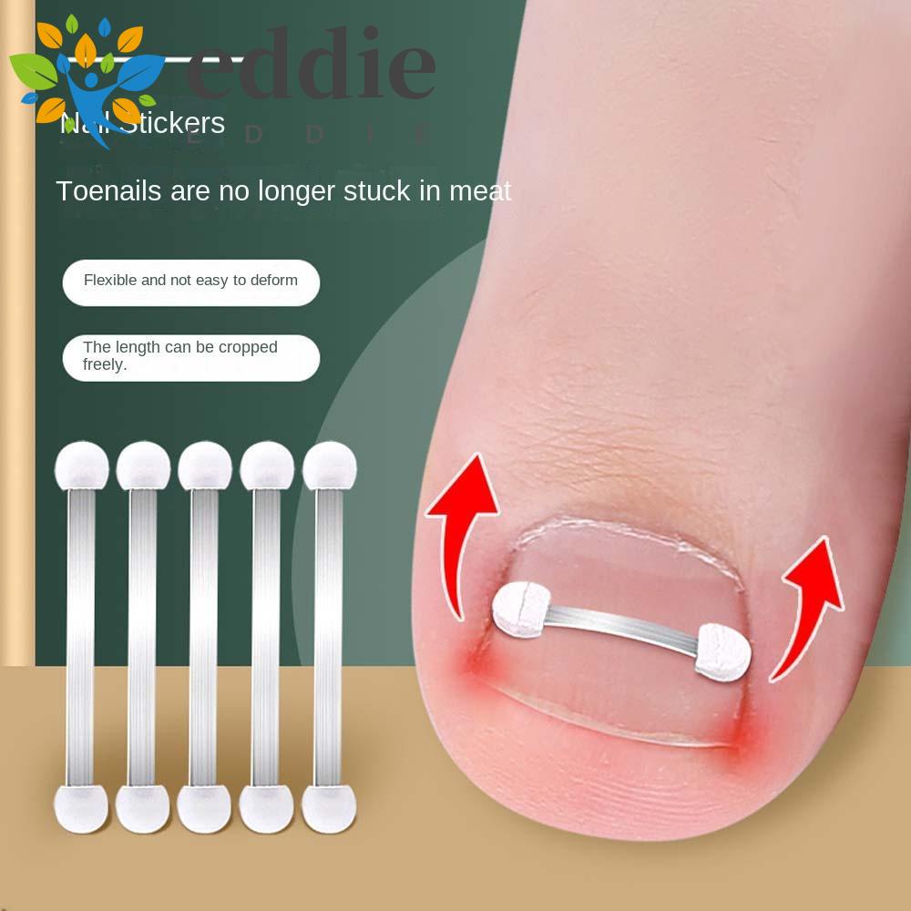 Đai Nẹp Chỉnh Hình Móng Chân 26EDIE Chuyên Nghiệp