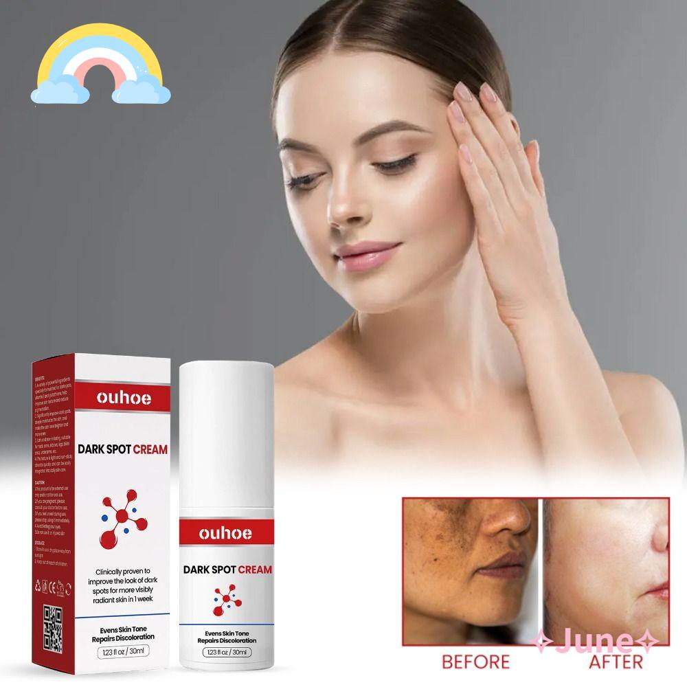 JUNE Kem Xóa Đốm Nâu / Tàn Nhang Làm Sáng Da Hiệu Quả