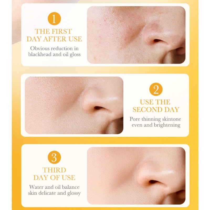 Set 10 Mặt Nạ Bioaqua Vitamin C Làm Sáng Da Kiềm Dầu Loại Bỏ Mụn Đầu Đen Làm Sạch Sâu 8g