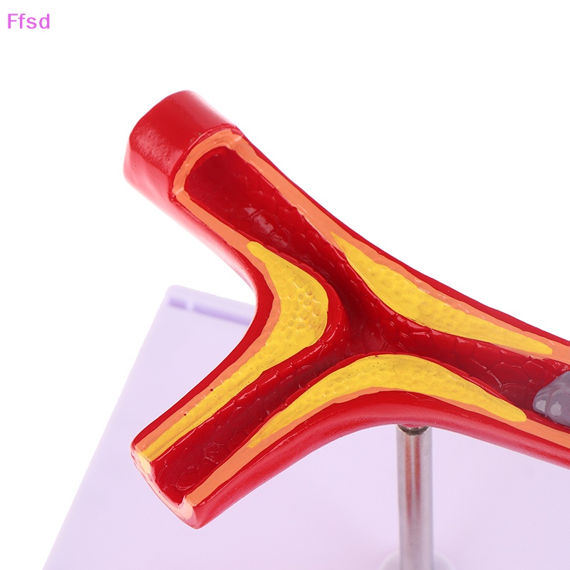 Tượng Vessel Con Người Nối Dài 50 Lần Cho Phòng Thí Nghiệm