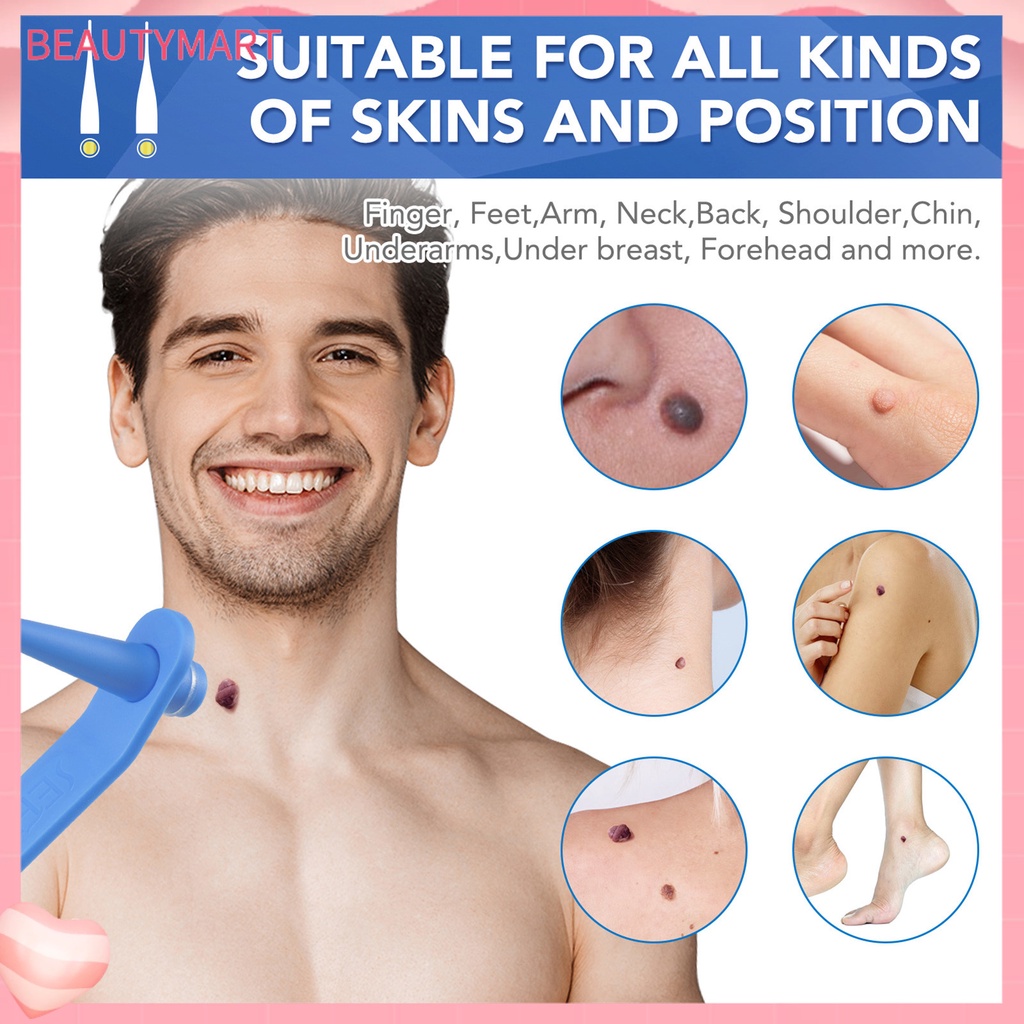 1 Bộ Dụng Cụ Loại Bỏ Mụn Cóc Trên Da Trọng Lượng Nhẹ Nhanh Chóng