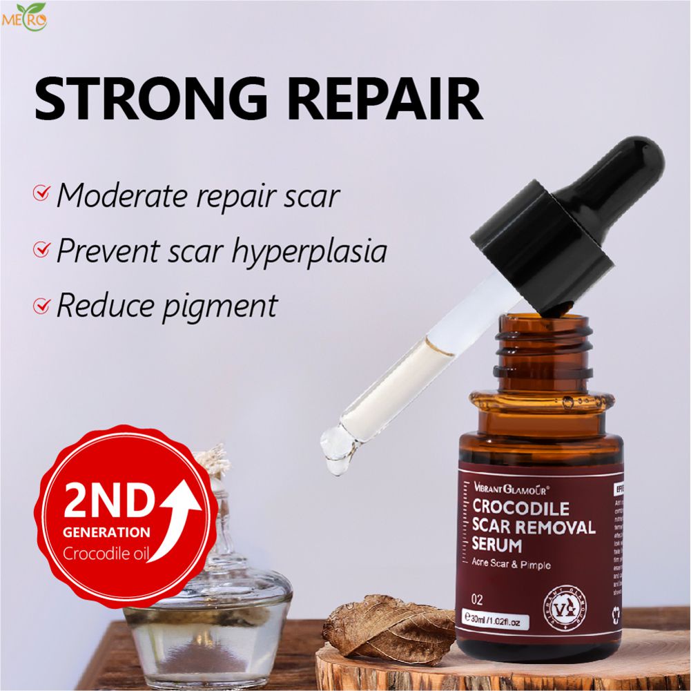 Vibrant Glamour Scar Repair Serum 30ml Điều trị mụn cá sấu thế hệ 2 Loại bỏ vết rạn da Loại bỏ sẹo mụn Dưỡng ẩm Chăm sóc da Beauty metro | BigBuy360 - bigbuy360.vn