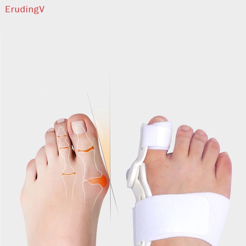 Nẹp Nẹp Chỉnh Hình Ngón Chân Giảm Đau