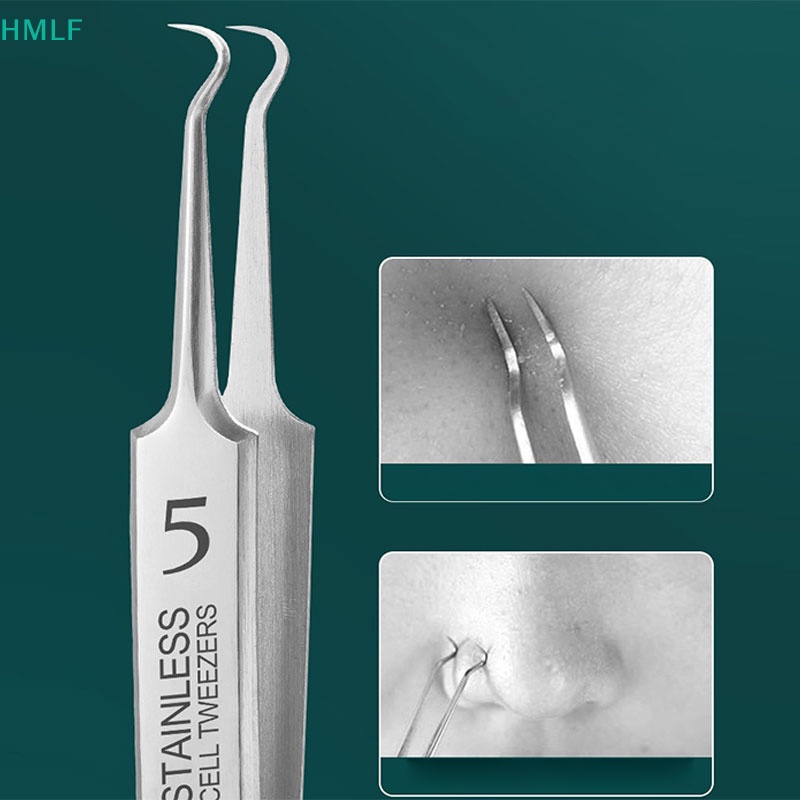 Nhíp Gắp Mụn Đầu Đen Chuyên Dụng Cho Salon Làm Đẹp