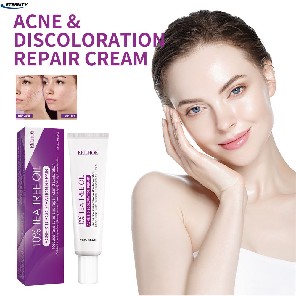 Kem Trị Tàn Nhang Trắng Da EELHOE Loại Bỏ Hiệu Quả Kem Trị Nám Loại Bỏ Các Vết Thâm Nám Melanin Dưỡng Ẩm Làm Sáng Mịn Mặt Chăm Sóc Da Sẵn Sàng