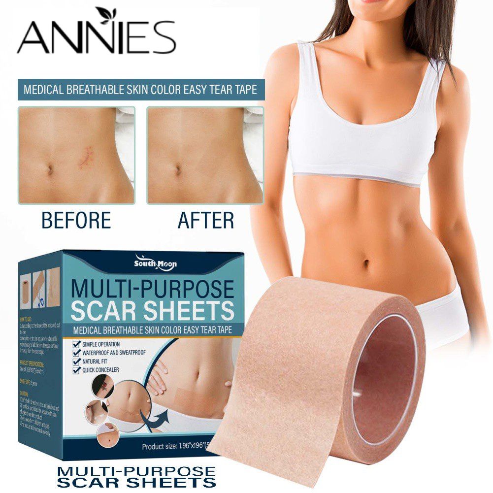 Cuộn miếng dán che khuyết điểm da ANNIES gel silicone che phủ mụn sẹo vết thương tông màu nude phục hồi