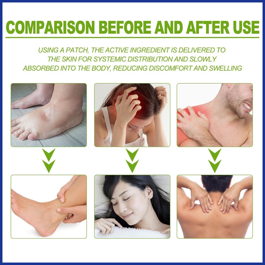 Set 30 Miếng Dán Giảm Đau Cơ Bắp Hiệu Quả