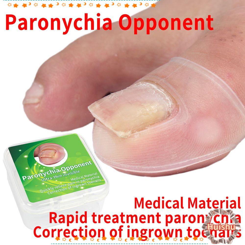 HS 1 Cặp Dụng Cụ Chỉnh Sửa Móng Chân Siêu Mỏng Vô Hình Paronychia