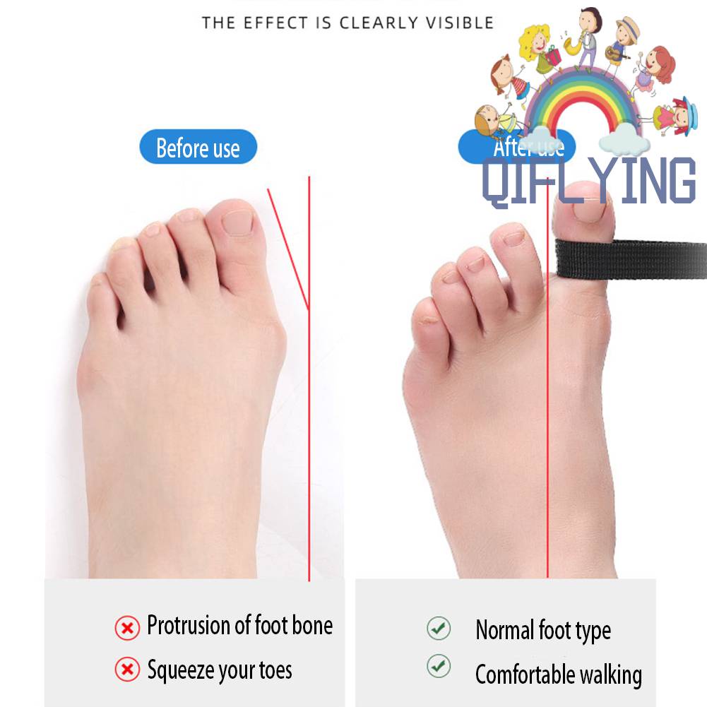 Dây Đai Chỉnh Hình Ngón Chân Cái