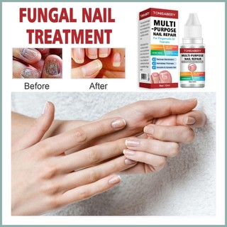Tinh Chất Phục Hồi Móng Hư Tổn 10ml