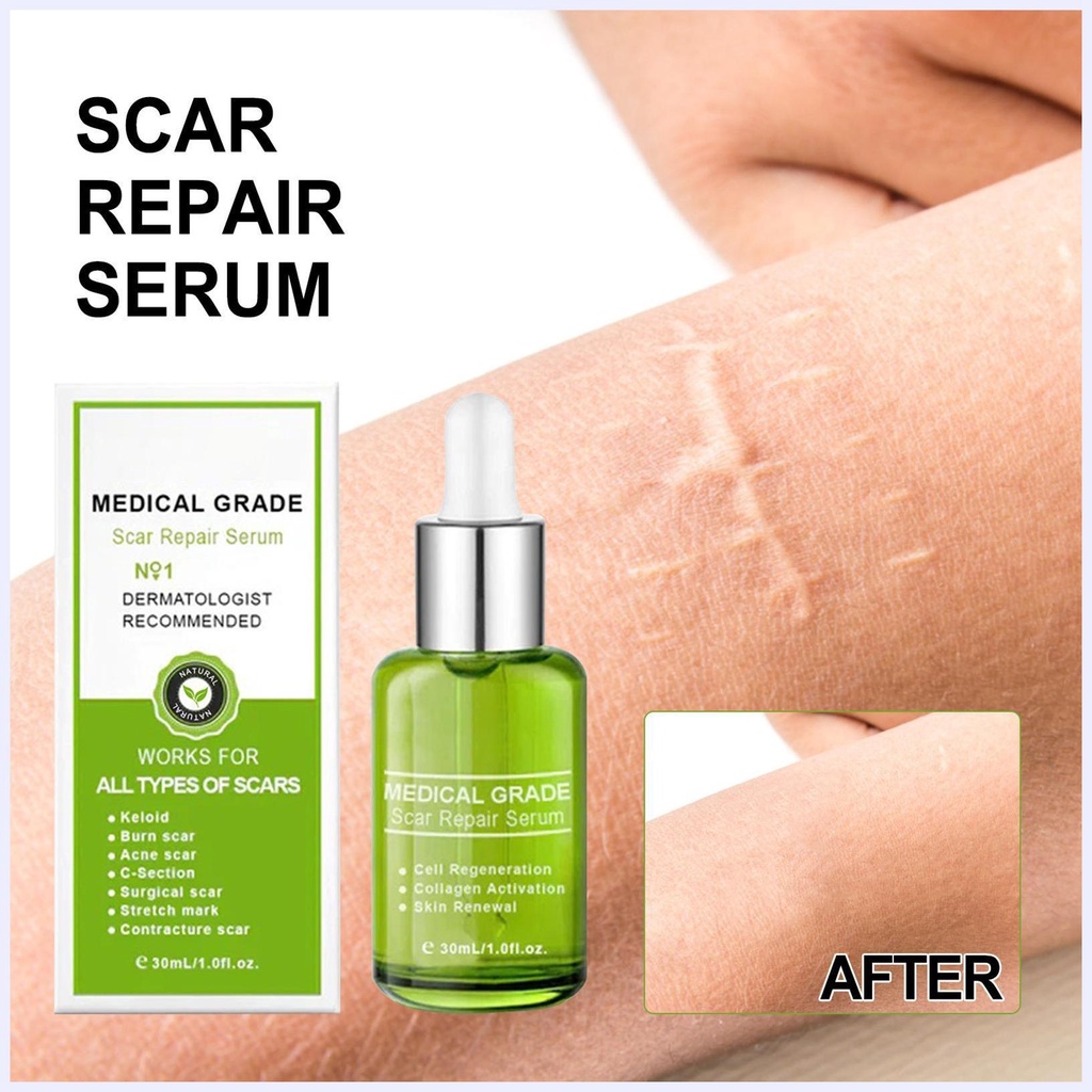 Serum trị sẹo cao cấp, Serum trị sẹo y tế, Serum trị sẹo tự nhiên cho mọi loại sẹo