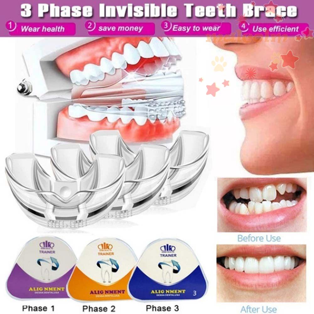 Nẹp Căn Chỉnh Malcom ​Răng 3 Sân Khấu TPU. Bộ Dụng Cụ Bảo Vệ Răng Bằng Silicone Vô Hình