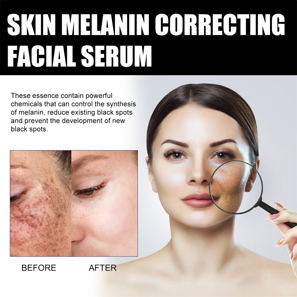 Serum điều chỉnh sắc tố da mặt JULYSTAR giảm vết thâm hàng ngày