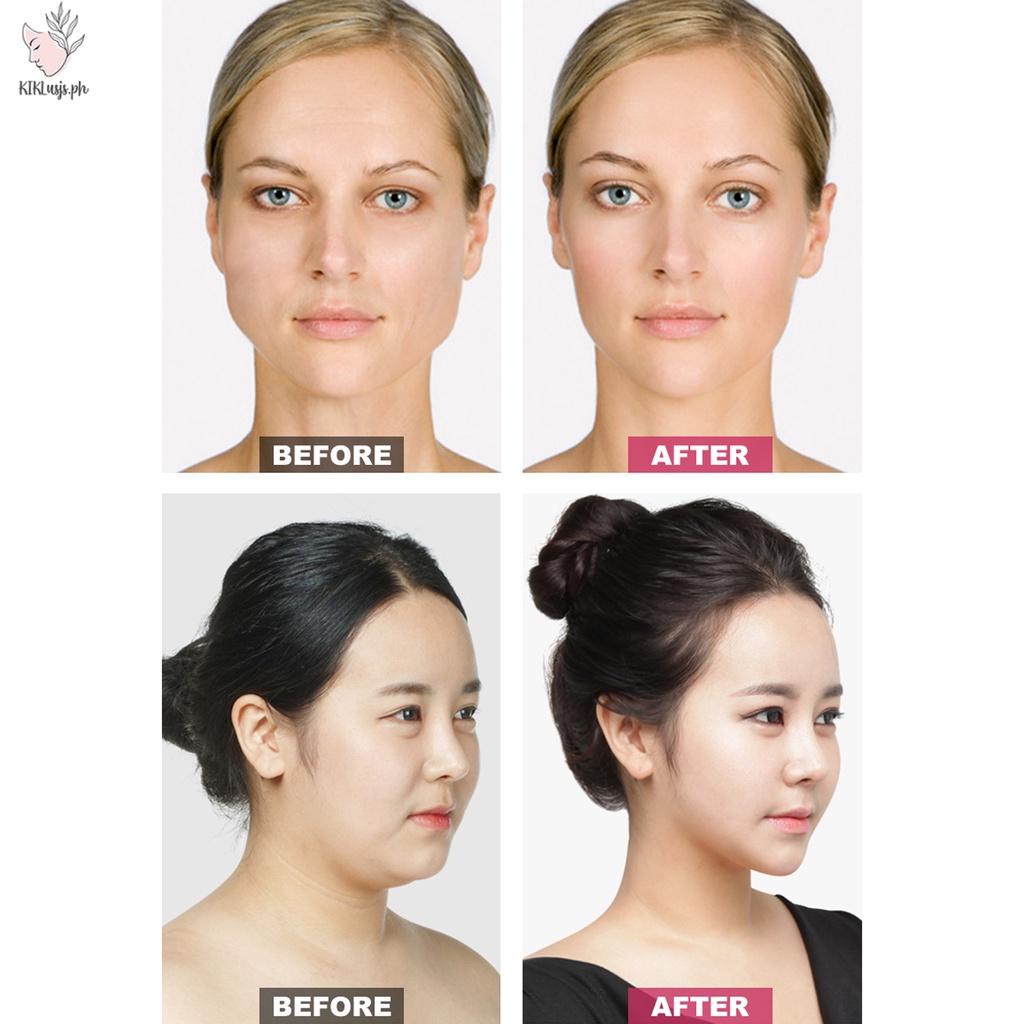 60 Miếng Dán Mặt Mỏng Vô Hình Hình Hình Chữ V Chin Line Sagging Nâng Miếng Dán Mặt Chống Nhăn Da Nâng Băng Facelifting Patch