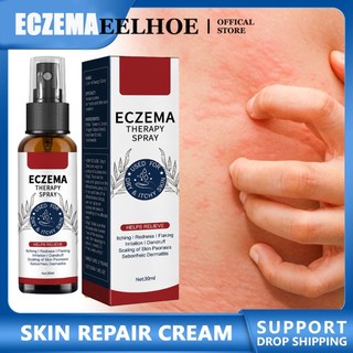 Thuốc bôi ngoài da EELHOE hỗ trợ giảm các vấn đề về da