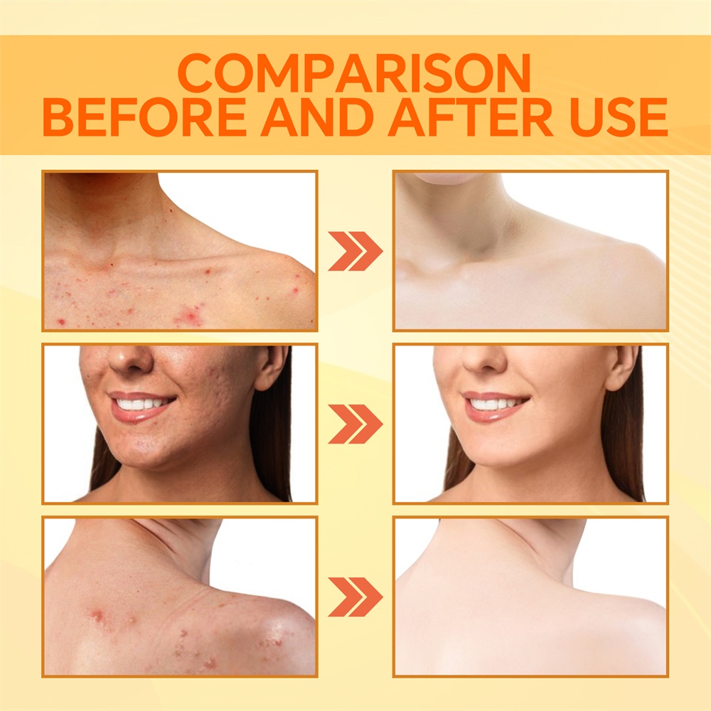 Xà Phòng Axit Kojic Làm Sáng Da Tay Làm Sạch Sâu