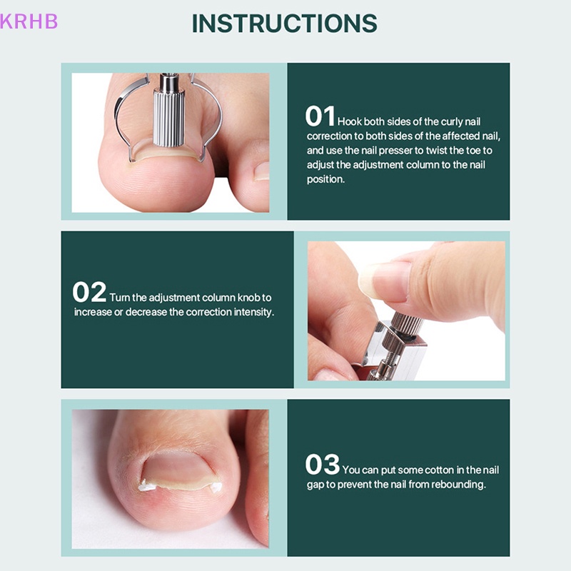 Dụng Cụ Định Hình Móng Chân Mọc Ngược Mới