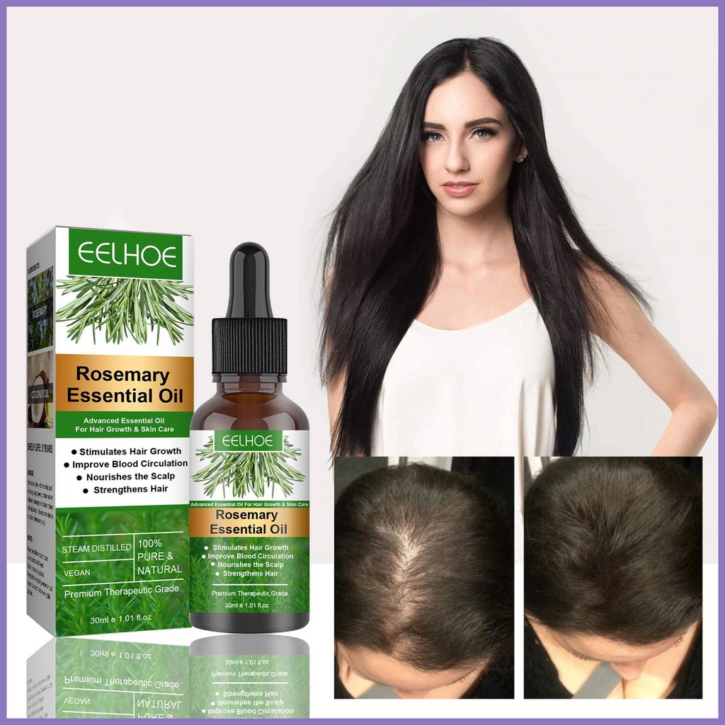Tinh Chất Kích Thích Mọc Tóc 30ml Nuôi Dưỡng Da Đầu Và Tóc nota2vn