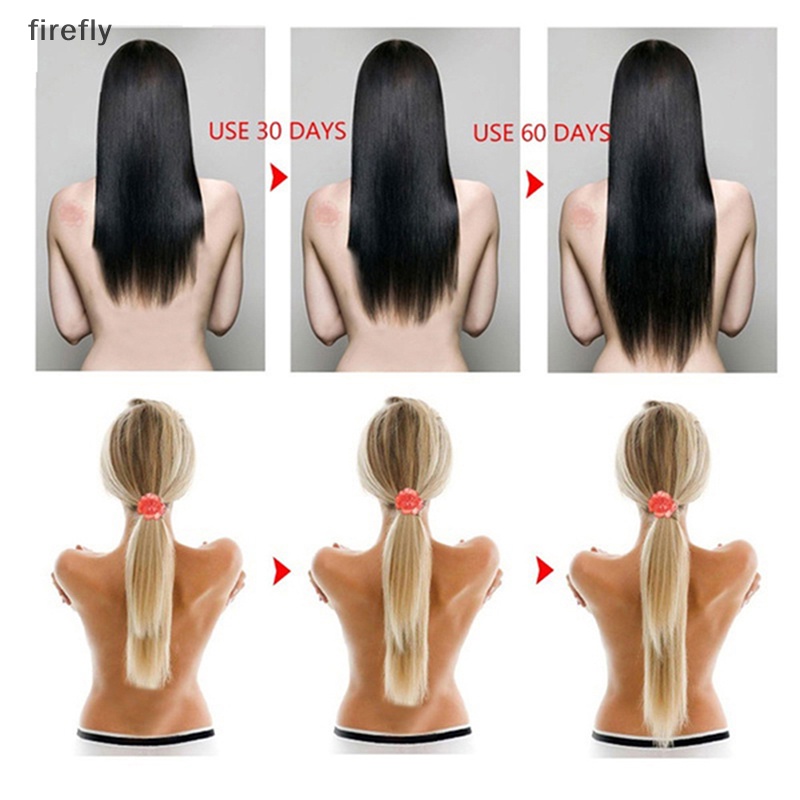 Dầu Gội Đầu Chiết Xuất Gạo Kích Thích Mọc Tóc Hiệu Quả