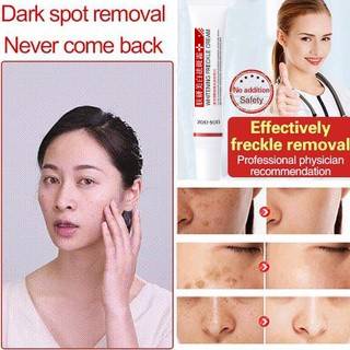 Kem Trị Nám Hiệu Quả Kem Tàn Nhang Trắng Da Xóa Nám Kem Xóa Vết Thâm Melanin Tẩy Nám Làm Sáng Da Chống Lão Hóa Làm Sáng Da AubessDS