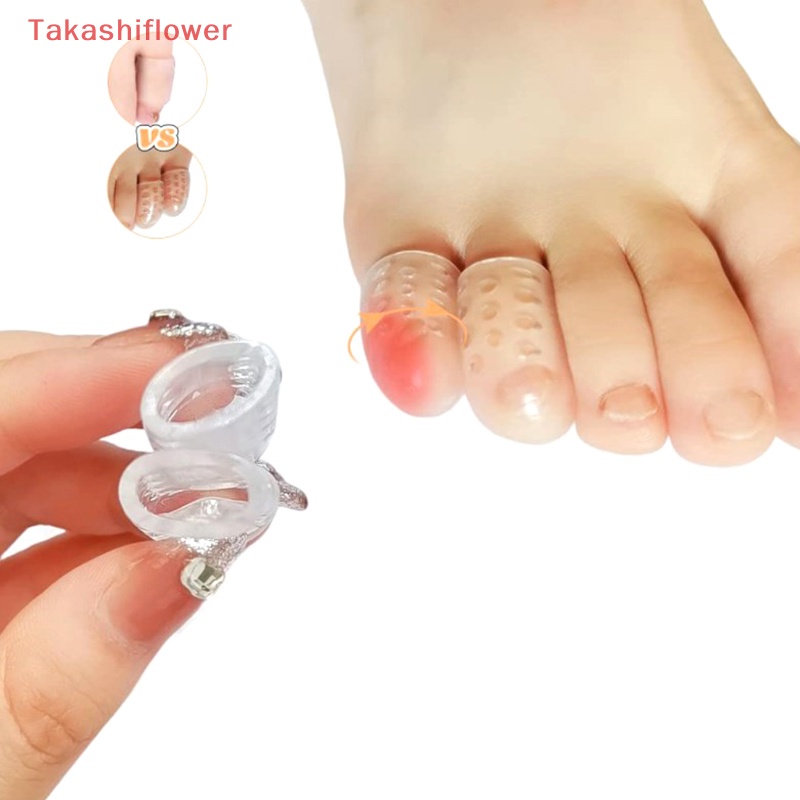Set 10 Miếng Đệm Tách Ngón Chân Bằng Silicon Mềm Thoáng Khí Chống Ma Sát