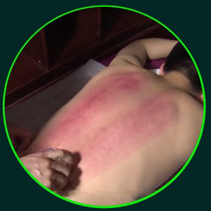 Set 4 Cốc Silicone Hút Chân Không Mát Xa Chống Cellulite Chăm Sóc Sức Khỏe