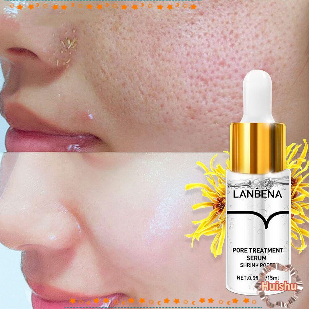 HS Serum Chăm Sóc Da Mặt Thu Nhỏ Lỗ Chân Lông Làm Sáng Da Tiện Dụng