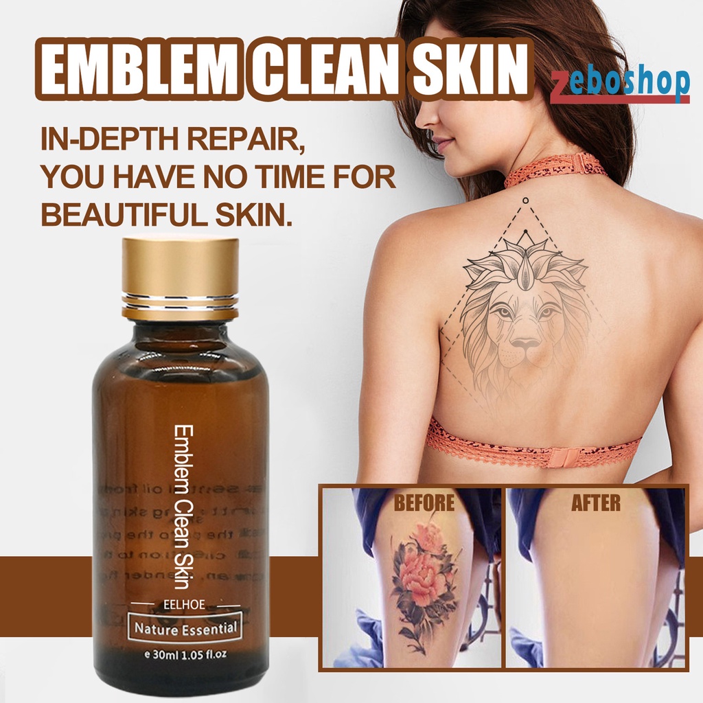 Dung Dịch Tẩy Hình Xăm Chiết Xuất Thực Vật 30ml An Toàn Dễ Sử Dụng