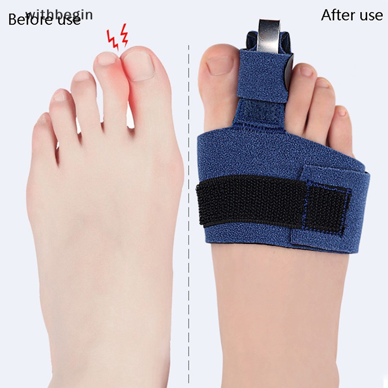 1 Dụng Cụ Nẹp Điều Chỉnh Ngón Chân Cái Giảm Đau Ease Valgus