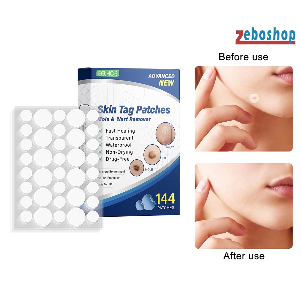 Hộp 144 Miếng Dán Loại Bỏ Mụn Cóc Dịu Nhẹ Nhanh Chóng Không Gây Kích Ứng Da Cho Người Lớn