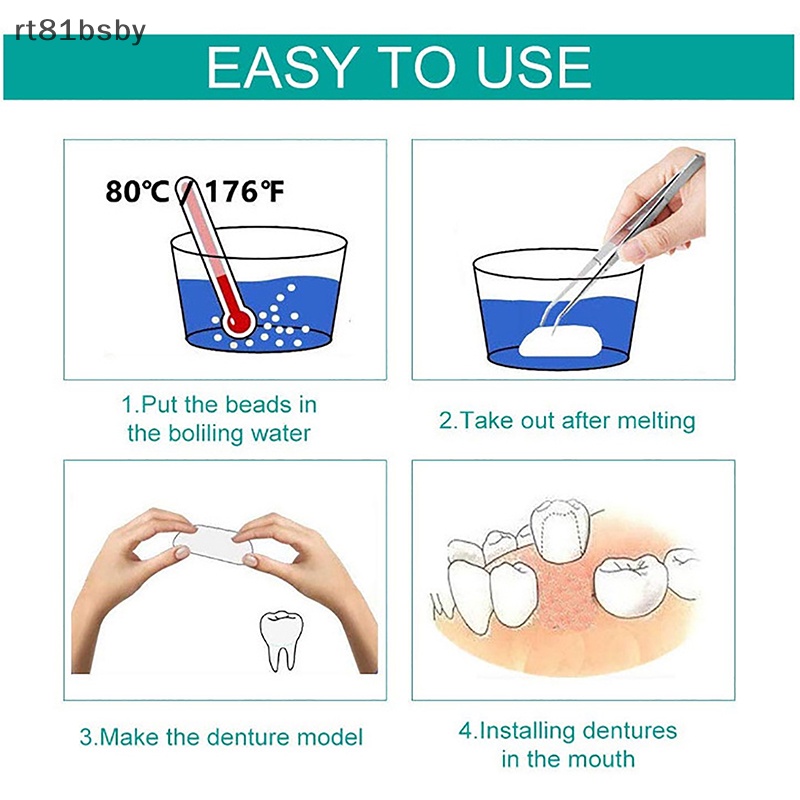 Keo Dán Giả Răng Và Khoảng Cách Răng Giả Bằng Nhựa Resin Tự Dính